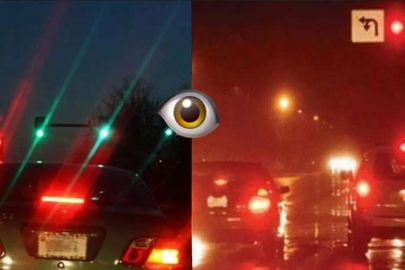 Astigmat: Nedenleri, Belirtileri ve Modern Tedavi Yöntemleri