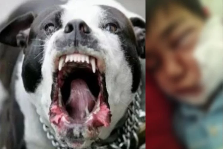 Başkanın Köpeği Çocuğa Saldırdı Çocuğun Yüzüne 20 Dikiş Atıldı